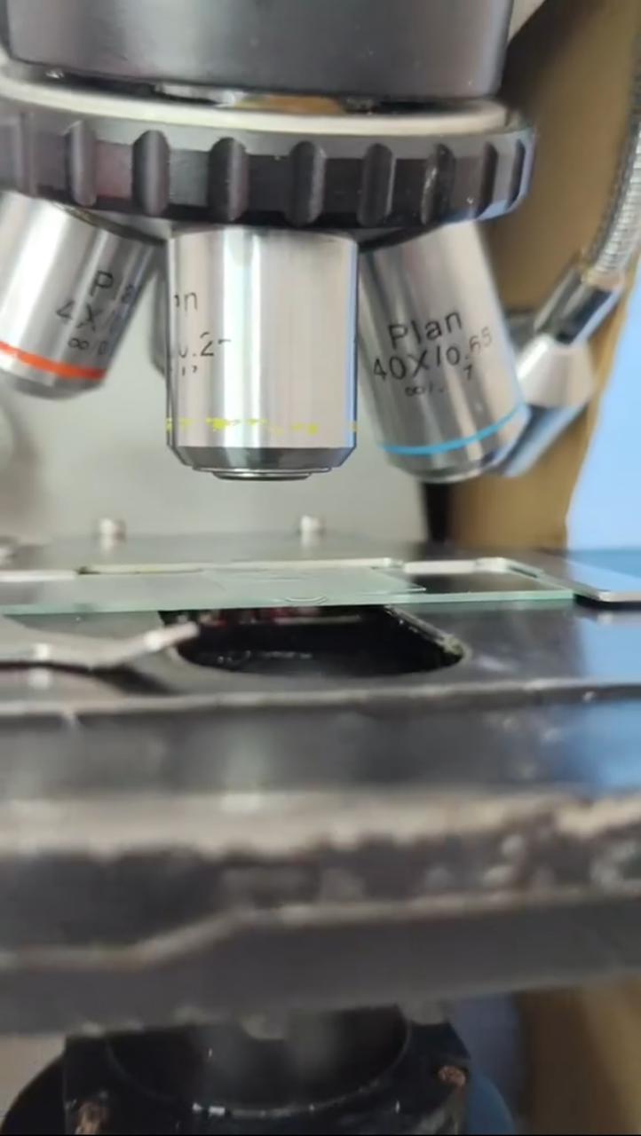 A Shocking Discovery: The Viral Microscope Video That Left Everyone Speechless